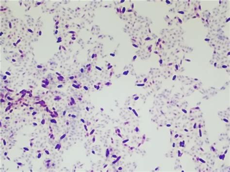 e coli acid fast stain|kinyoun acid fast stain.